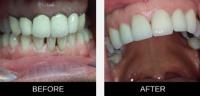 Best Dentist Covina : Elite Care Dental image 2